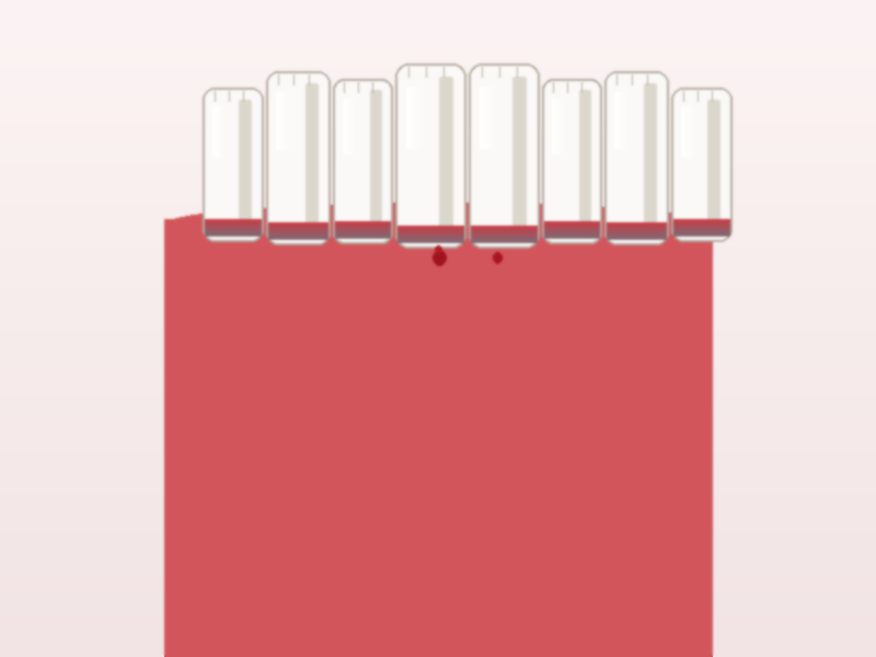 Bleeding Gums