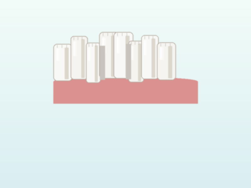 Crowding & Overlapping